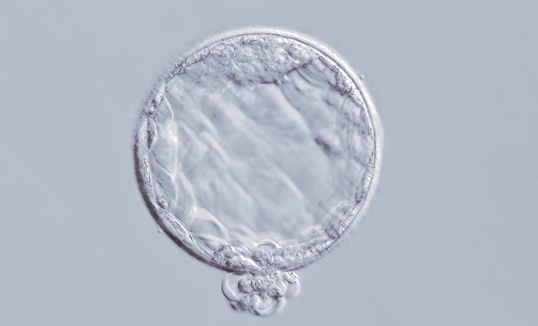 embryo transfer blastocyst