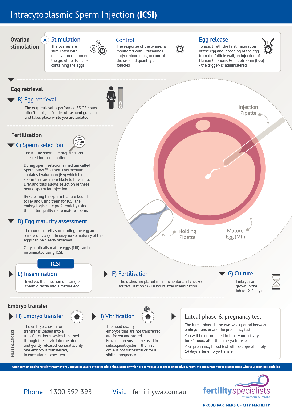 Intracytoplasmic Sperm Injection (ICSI) Infographic